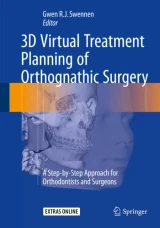 3D Virtual Treatment Planning of Orthognathic Surgery by Gwen Swennen