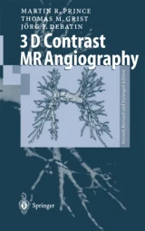 3D Contrast MR Angiography by Martin R. Prince | Thomas M. Grist | Jorg F. Debatin