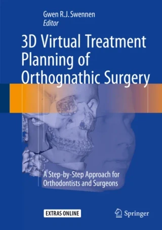 3D Virtual Treatment Planning of Orthognathic Surgery by Gwen Swennen