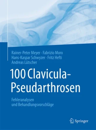 100 Clavicula-Pseudarthrosen by Rainer-Peter Meyer | Fabrizio Moro | Hans-Kaspar Schwyzer | Fritz Hefti
