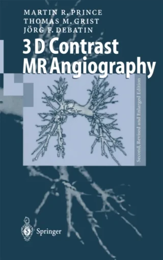 3D Contrast MR Angiography by Martin R. Prince | Thomas M. Grist | Jorg F. Debatin