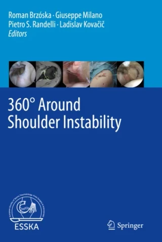 360(deg) Around Shoulder Instability by Ladislav Kovacic | Pietro S. Randelli | Giuseppe Milano | Roman Brzoska
