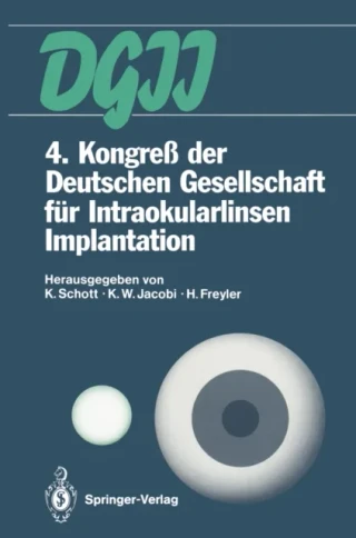 4. Kongreß der Deutschen Gesellschaft für Intraokularlinsen Implantation by Heinz Freyler | Karl W. Jacobi | Klaus Schott