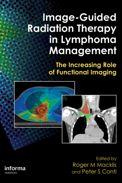 Image-Guided Radiation Therapy in Lymphoma Management: The Increasing Role of Functional Imaging