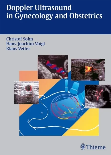 Doppler Ultrasound in Gynecology and Obstetrics by Christof Sohn | Hans-Joachim Voigt | Klaus Vetter