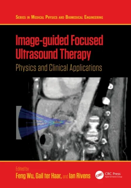 Image-guided Focused Ultrasound Therapy by Ian Rivens | Gail ter Haar | Feng Wu