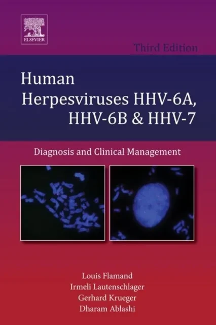 Human Herpesviruses HHV-6A, HHV-6B and HHV-7 by Dharam Ablashi | Gerhard Krueger | Irmeli Lautenschlager | Louis Flamand
