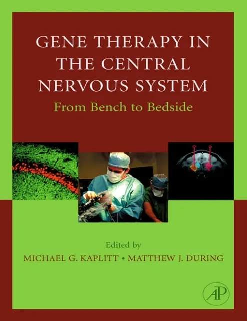 Gene Therapy of the Central Nervous System: From Bench to Bedside by Matthew During | Michael G. Kaplitt
