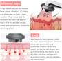 Thermal body massager