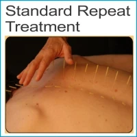 Standard repeat treatment $75.00