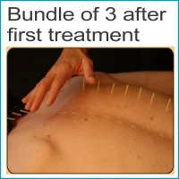 Bundle of 3 after first treatment $200.00