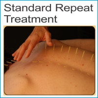 Standard repeat treatment $75.00