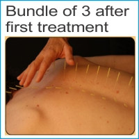 Bundle of 3 after first treatment $200.00