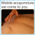 Mobile acupuncture we come to you $225.00