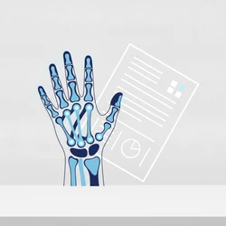 DMSO for Rheumatoid Arthritis and Joint Pain: What Real Users Say