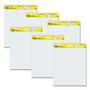 Post-it Easel Pads Super Sticky Vertical-Orientation Self-Stick Easel Pads, Quadrille Rule (1 sq/in), 25 x 30, White, 30 Sheets, 6/Pack View Product Image