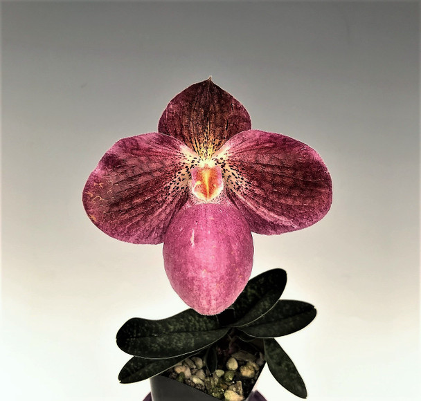 Orqa tomondan vaginani oching