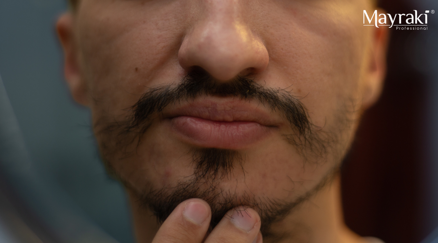 Patchy Beard Strategy: A Beginner Beard Growth Oil Routine