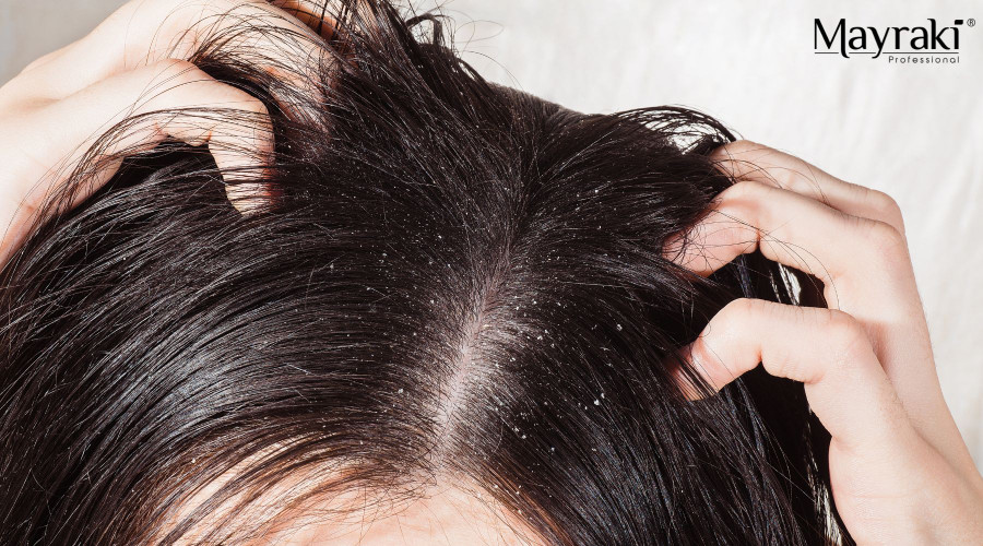 How to Build a Winter Dryness Plan for Sensitive Scalps