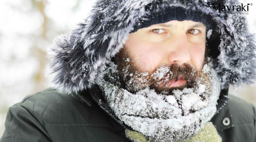 How to Deal with Beard Itch During Winter