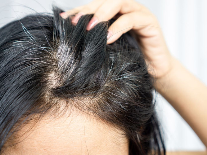 Why Anti-Gray Hair Treatments May Not Work for Everyone (and Why They Still Can for Most) Why Anti-Gray Hair Treatments May Not Work for Everyone (and Why They Still Can for Most)
