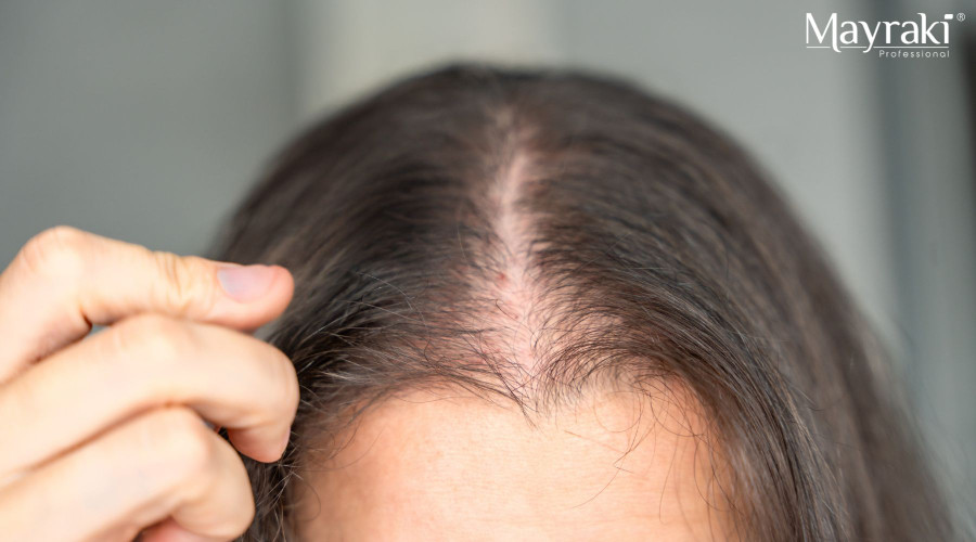 Patchy Areas Strategy for Busy People