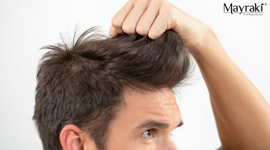 The Role of Biotin in Men’s Hair Growth: What Science Says and How to Use It