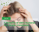 5 Benefits of Using Natural Dry Scalp Treatment 5 Benefits of Using Natural Dry Scalp Treatment