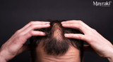 Advanced Tips and Strategy for Patchy Areas for Fine Hair for Men in Spring