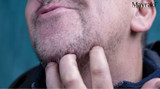 Beard Itch Remedies: How to Stop That Scratchy Beard Naturally
