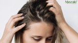 Combatting Androgenetic Alopecia