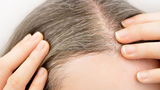 ​What Causes Grey Hair?