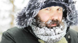 How to Deal with Beard Itch During Winter