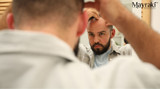 How to Prevent Receding Hairlines in Men: Effective Strategies That Truly Work