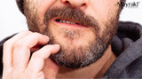 How to Treat Beardruff Naturally: Flake-Free Beard Solutions How to Treat Beardruff Naturally: Flake-Free Beard Solutions