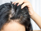 Why Anti-Gray Hair Treatments May Not Work for Everyone (and Why They Still Can for Most)