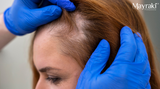 Travel Strategy for Patchy Hair Growth