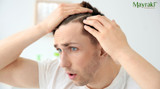 Understanding the Role of DHT in Hair Loss and Ways to Combat It