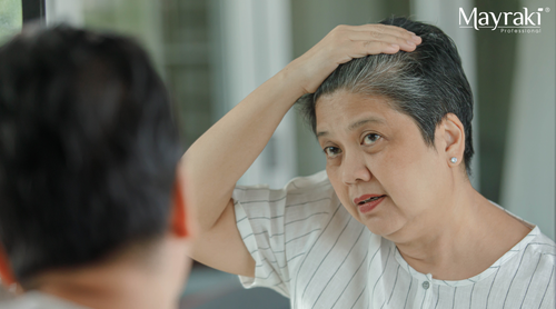 How to Cover Temple and Crown Grays Safely on Sensitive Scalps