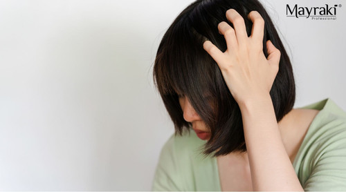 How to Manage Scalp Itchiness Naturally