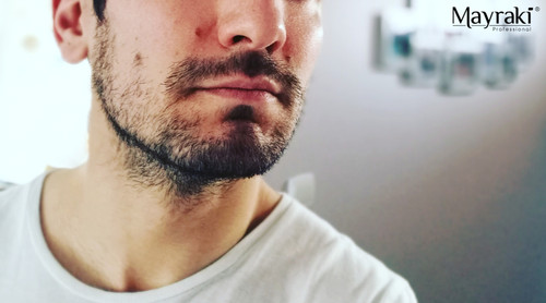 Patchy Beard Growth Remedies Patchy Beard Growth Remedies