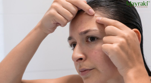 Pimples on Scalp: Causes and Natural Remedies