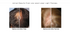 Mayraki Hair Growth Ulti-Nutra Laser System - Laser hair growth, effective laser therapy for hair loss for man and woman 