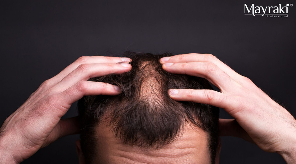 Orpatchy Advanced Tips and Strategy for Patchy Areas for Fine Hair for Men in ...