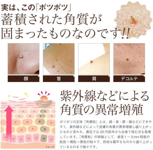 Ipocare EX Ipocare EX