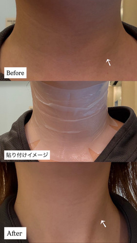 Ohm Neck Tightening Mask