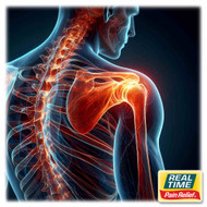 Adhesive Capsulitis: When Shoulder Movement Slowly Becomes Limited