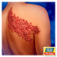 Beyond the Rash: Soothing Post-Herpetic Neuralgia After Shingles