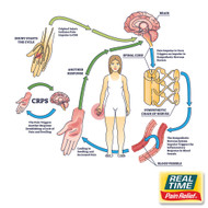 Complex Regional Pain Syndrome (CRPS): Topical Treatments Using Nature’s Ingredients