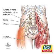 Meralgia Paresthetica: Managing Outer Thigh Nerve Pain with Targeted, Nature-Based Relief